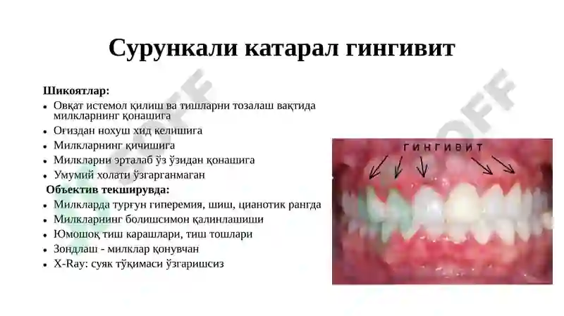 Preview 7