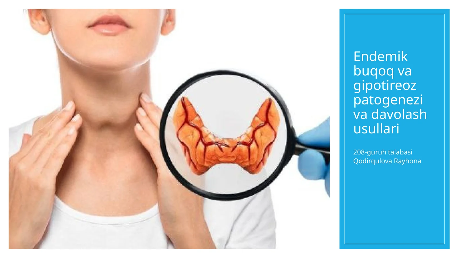endemik buqoq va gipotireoz patogenezi va davolash ishlari
